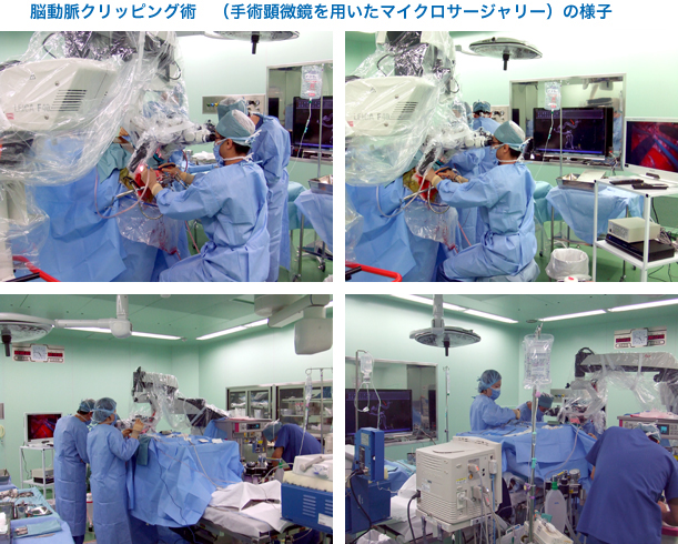 脳動脈瘤クリッピング術 | 藍の都脳神経外科病院