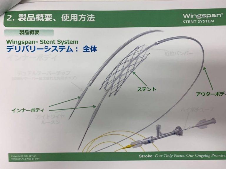 脳血管内手術治療科からのお知らせ最新治療wingspanステントを実施しています。 藍の都脳神経外科病院